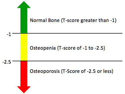 Bone Density: What Do the Numbers Mean?